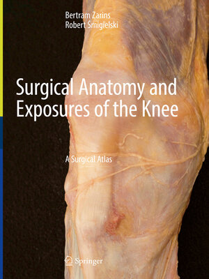 cover image of Surgical Anatomy and Exposures of the Knee